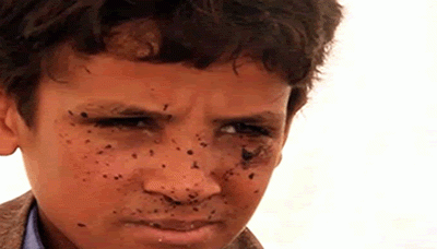 الطفل اليمني .. عقوبة الموت قصفاً! (تحقيق مصور)
